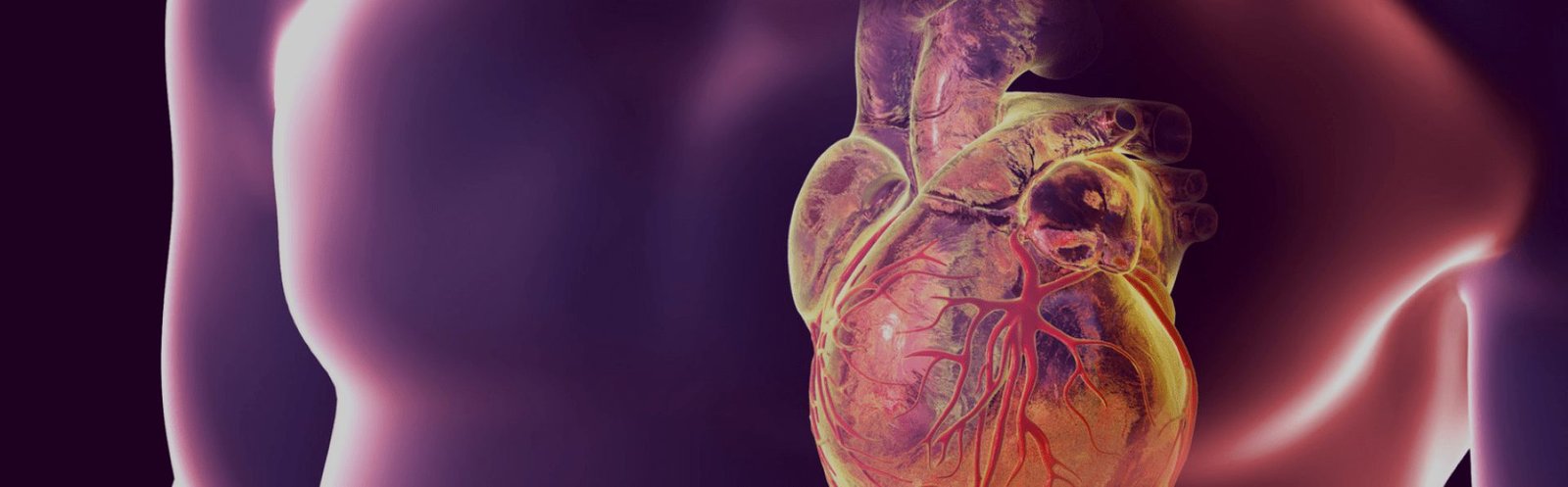 Aneurisma e Dissec&ccedil;&atilde;o da Aorta