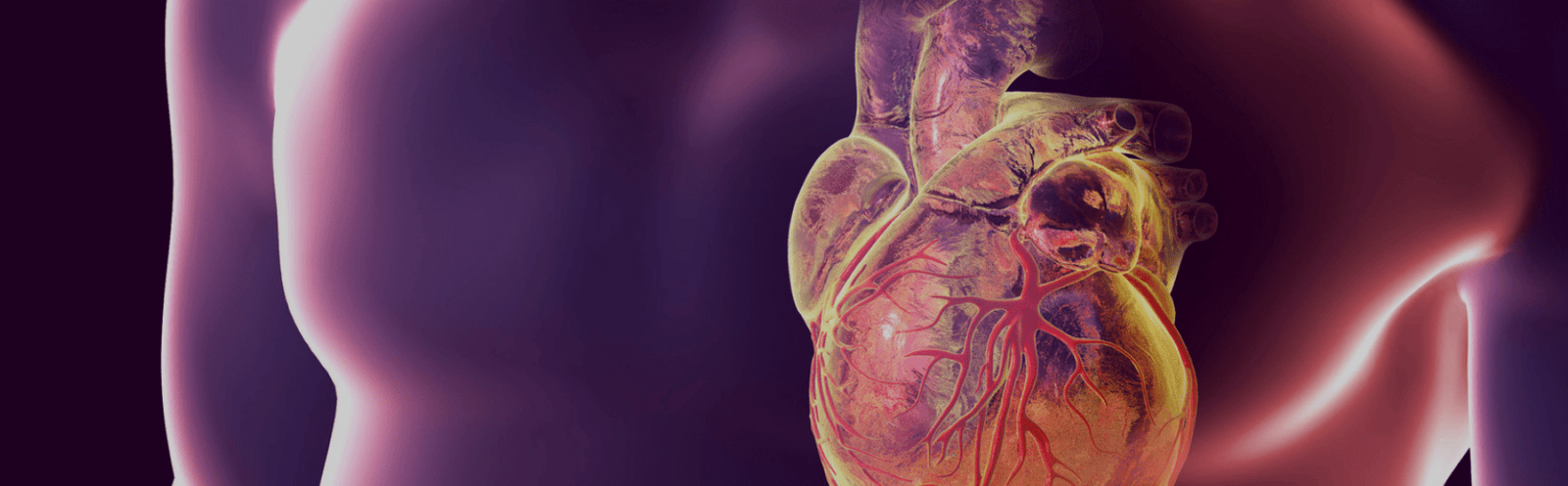 Aneurisma e Dissecção da Aorta