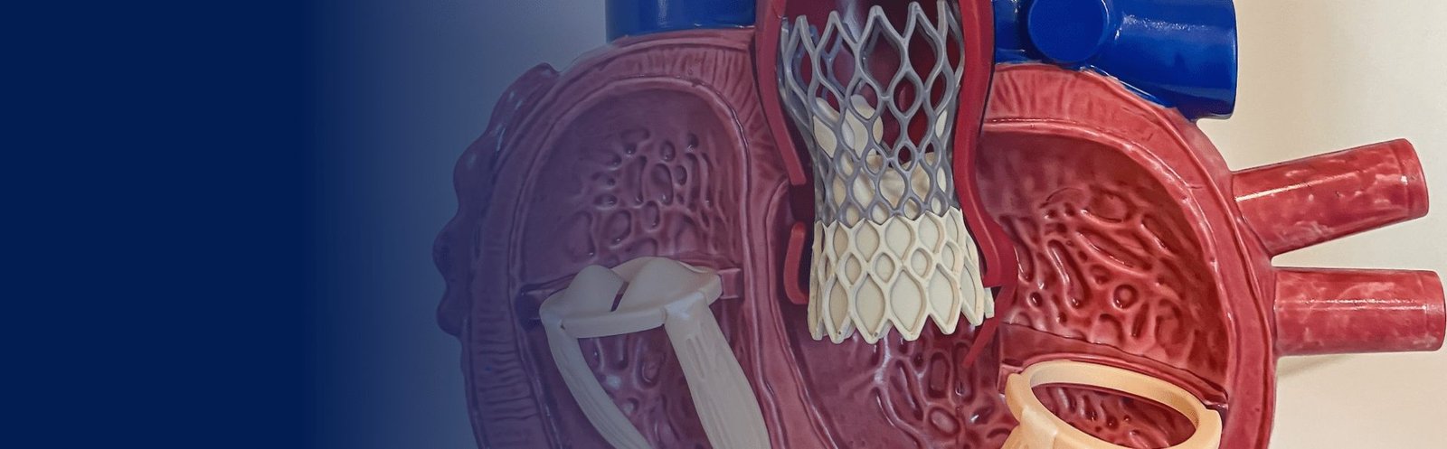Cirurgia Cardiovascular