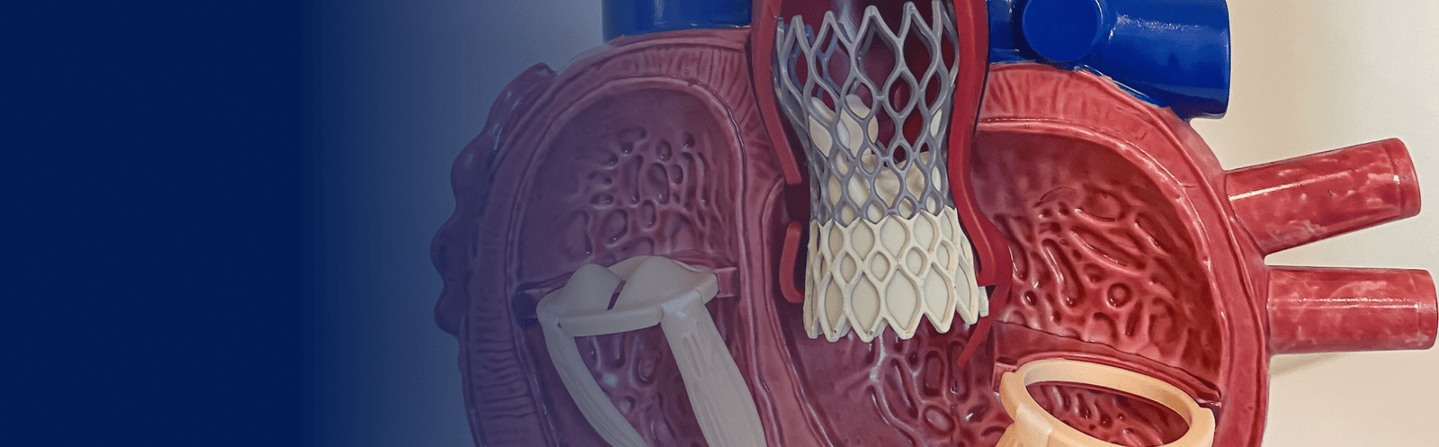 Cirurgia Cardiovascular